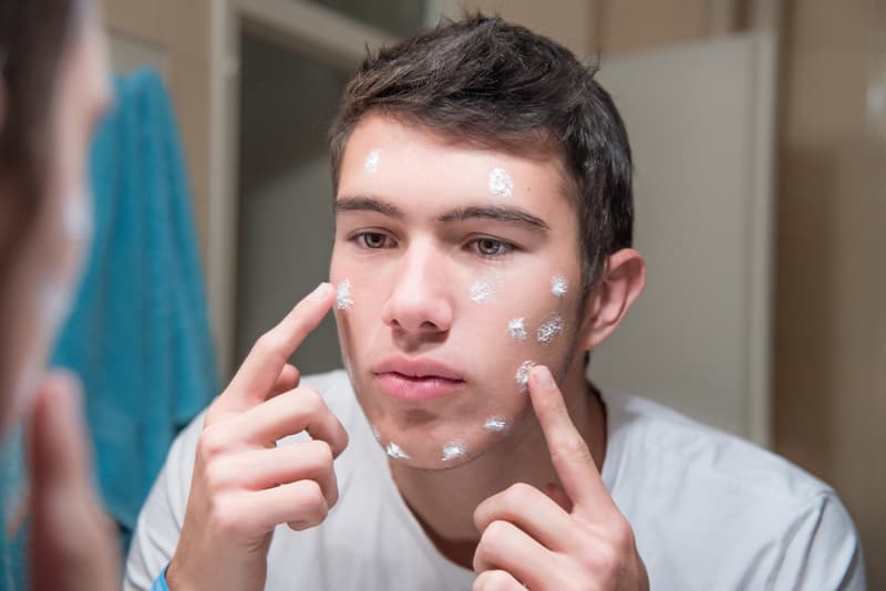 man using tretinoin cream