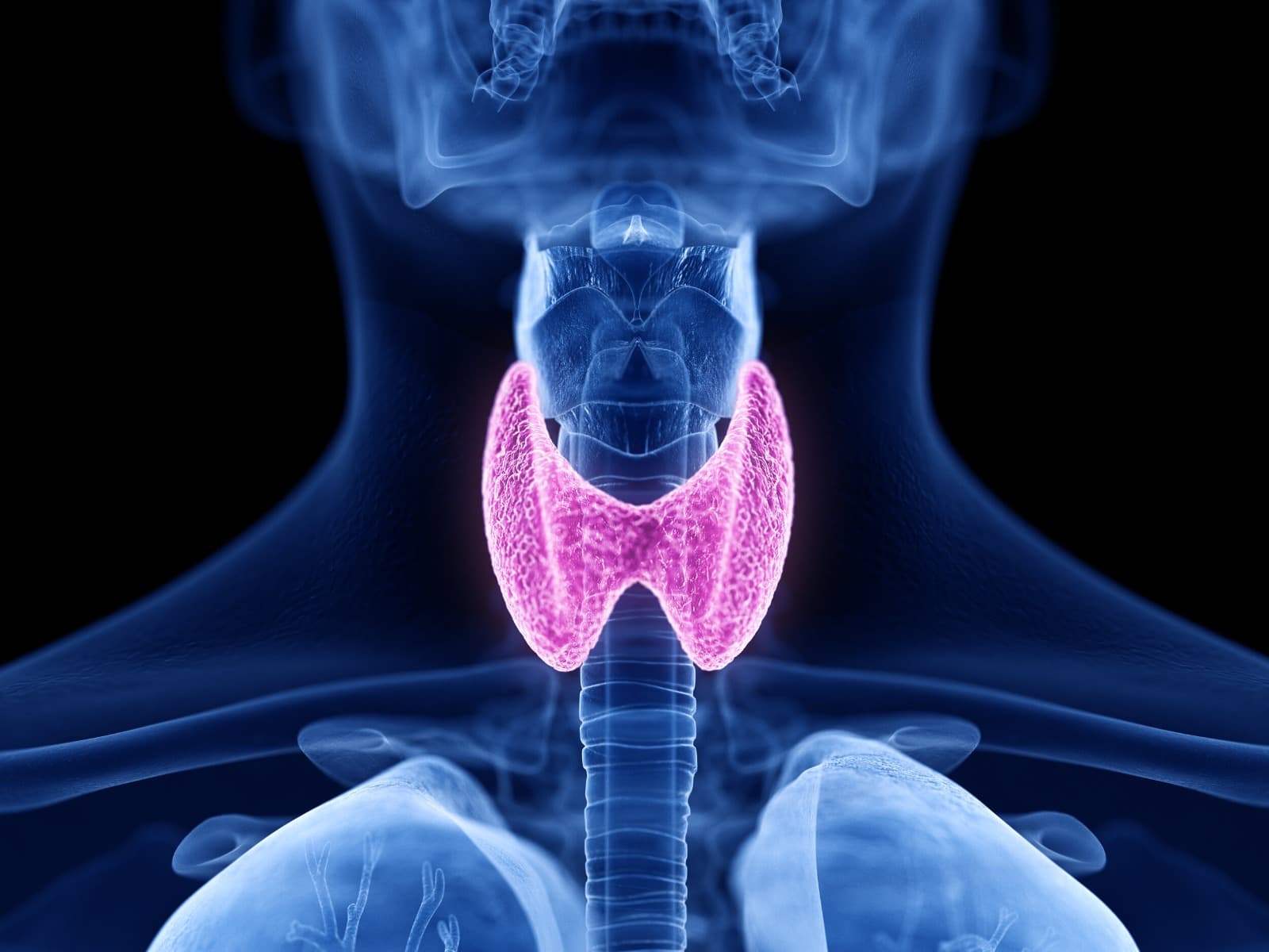 x ray image of a thyroid gland